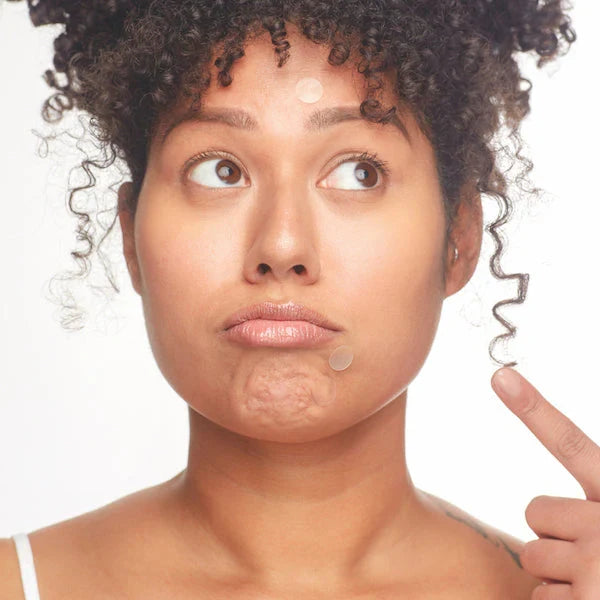Not A Spot Acne Pimple Patch